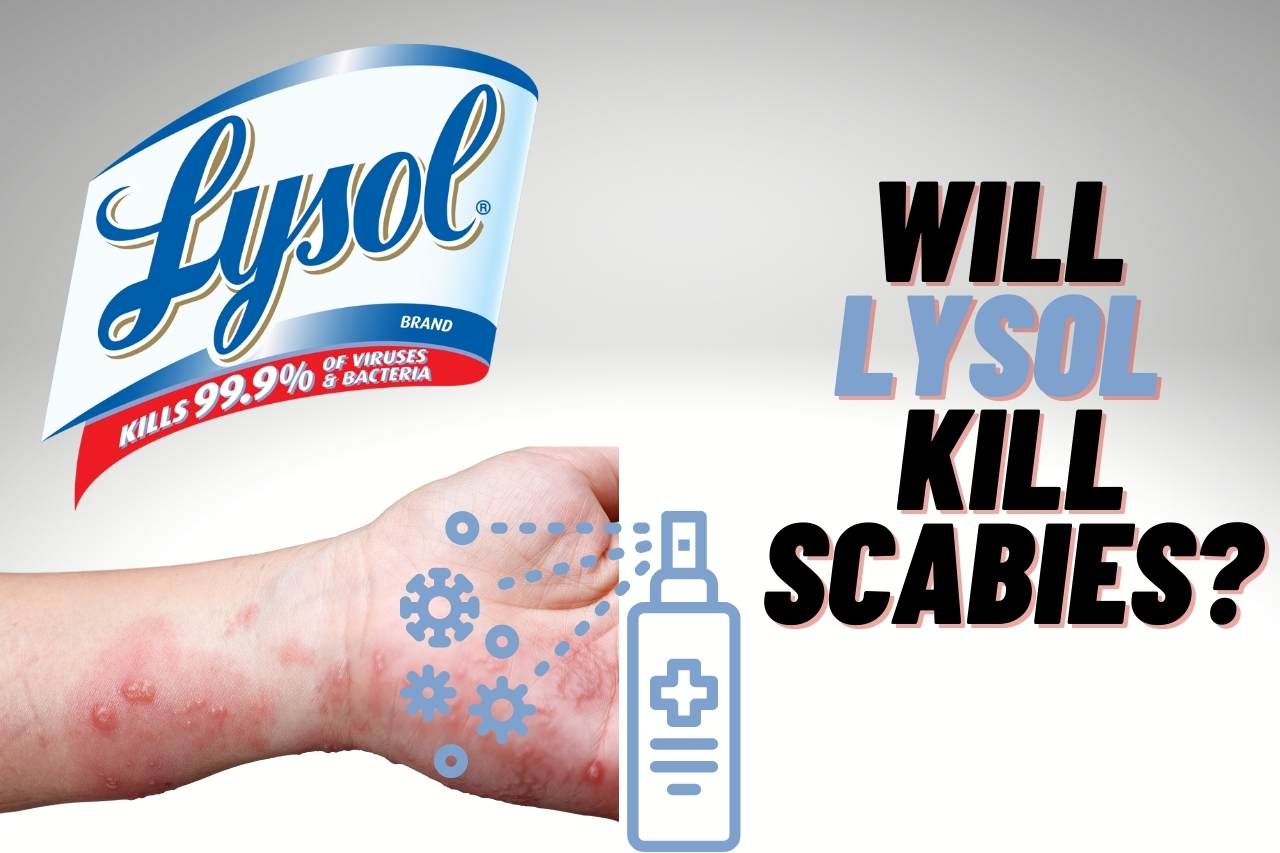 Will Lysol Kill Scabies